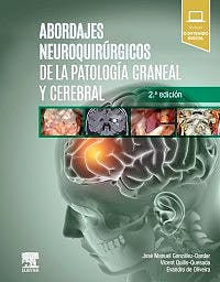 Abordajes Neuroquirúrgicos De La Patología Craneal Y Cerebral + Acceso Online