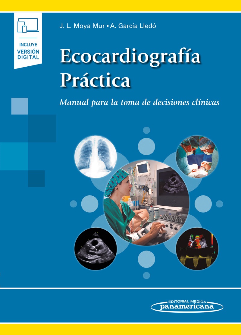 Ecocardiografía Práctica Manual Para La Toma De Decisiones Clínicas Incluye Ebook