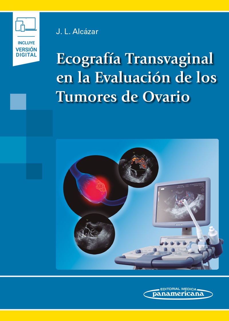 Ecografía Transvaginal En La Evaluación De Los Tumores De Ovario Incluye Ebook
