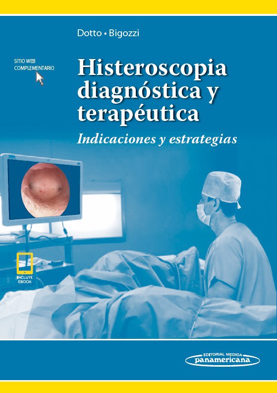 Histeroscopia Diagnóstica Y Terapéutica Indicaciones Y Estrategias Incluye Ebook