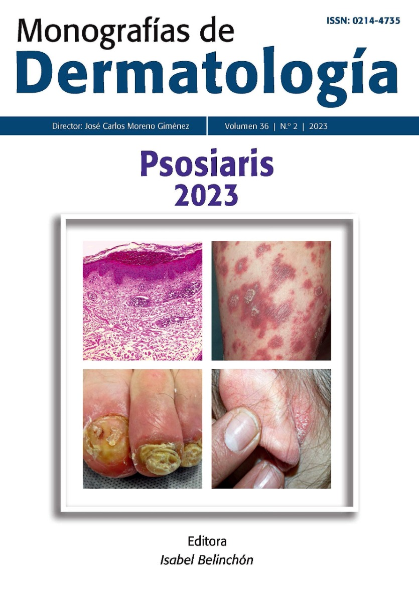 Monografías de Dermatología. Psoriasis 2023