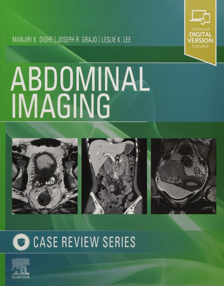 Abdominal Imaging, 1St Edition