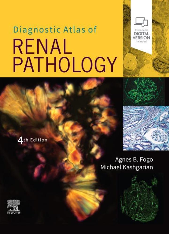 Diagnostic Atlas Of Renal Pathology, 4Th Edition