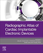 Radiographic Atlas Of Cardiac Implantable Electronic Devices, 1St Edition