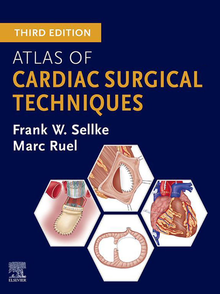 Atlas of Cardiac Surgical Techniques