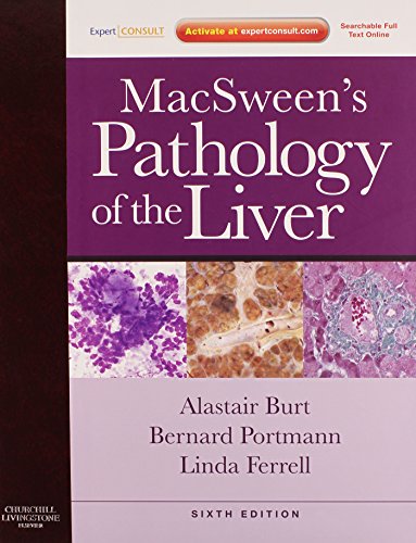 Macsweens Pathology Of The Liver: Expert Consult: Online And Print (Expert Consult Title: Online + Print)