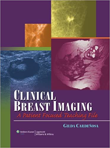 Clinical Breast Imaging: A Patient Focused Teaching File 1St Edición