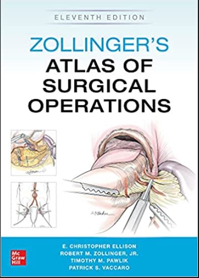 Zollinger'S Atlas Of Surgical Operations, Eleventh Edition 11Th Edición