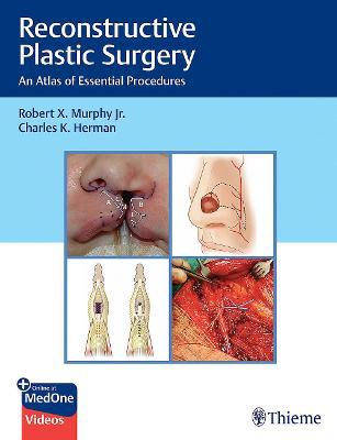 Reconstructive Plastic Surgery: An Atlas of Essential Procedures 1st Edición, Edición Kindle