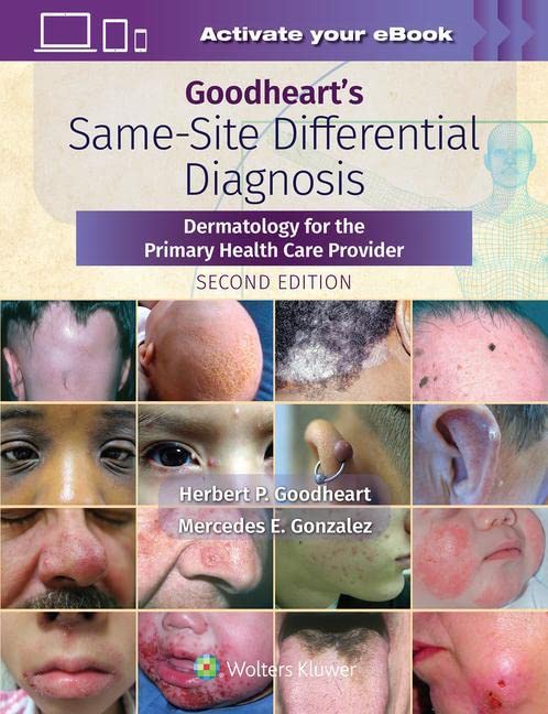 Goodheart'S Same-Site Differential Diagnosis