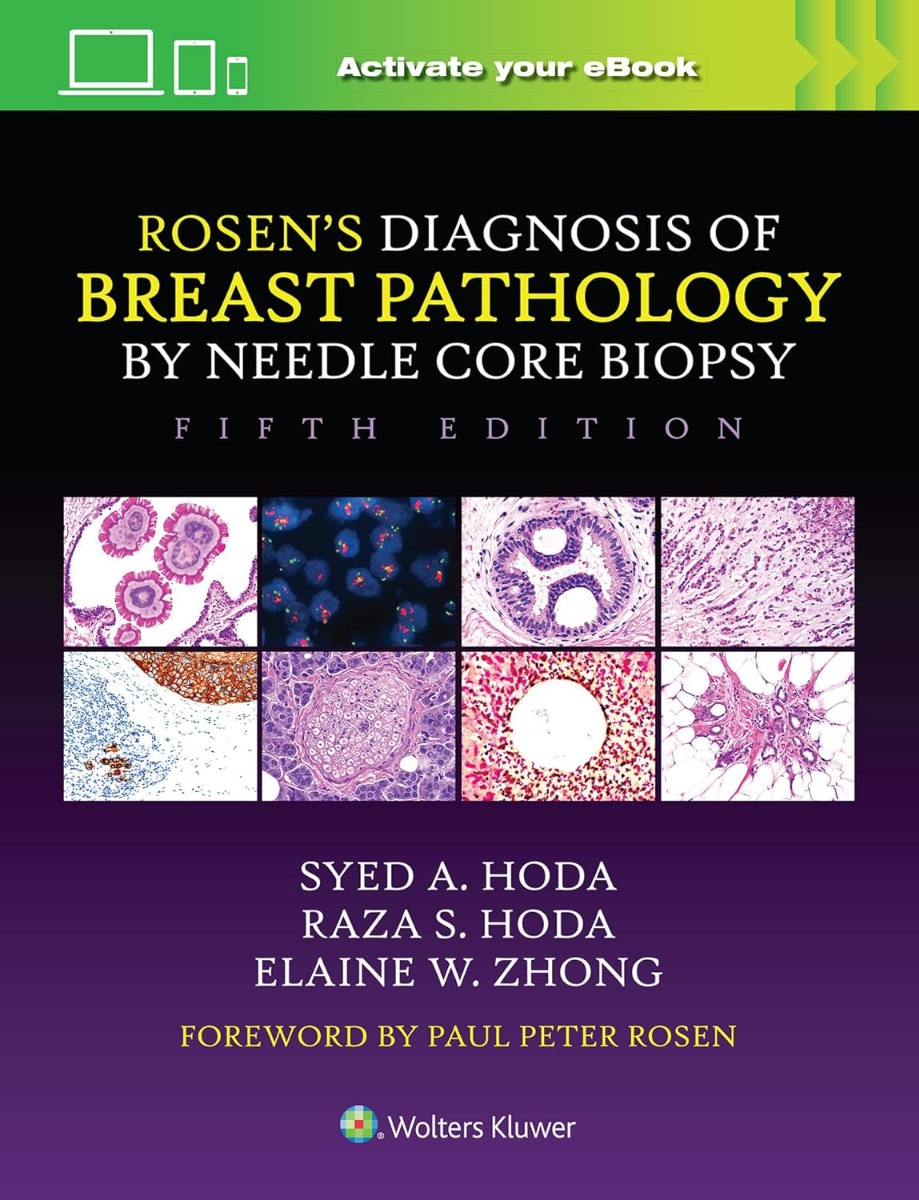 ROSEN's Diagnosis of Breast Pathology by Needle Core Biopsy