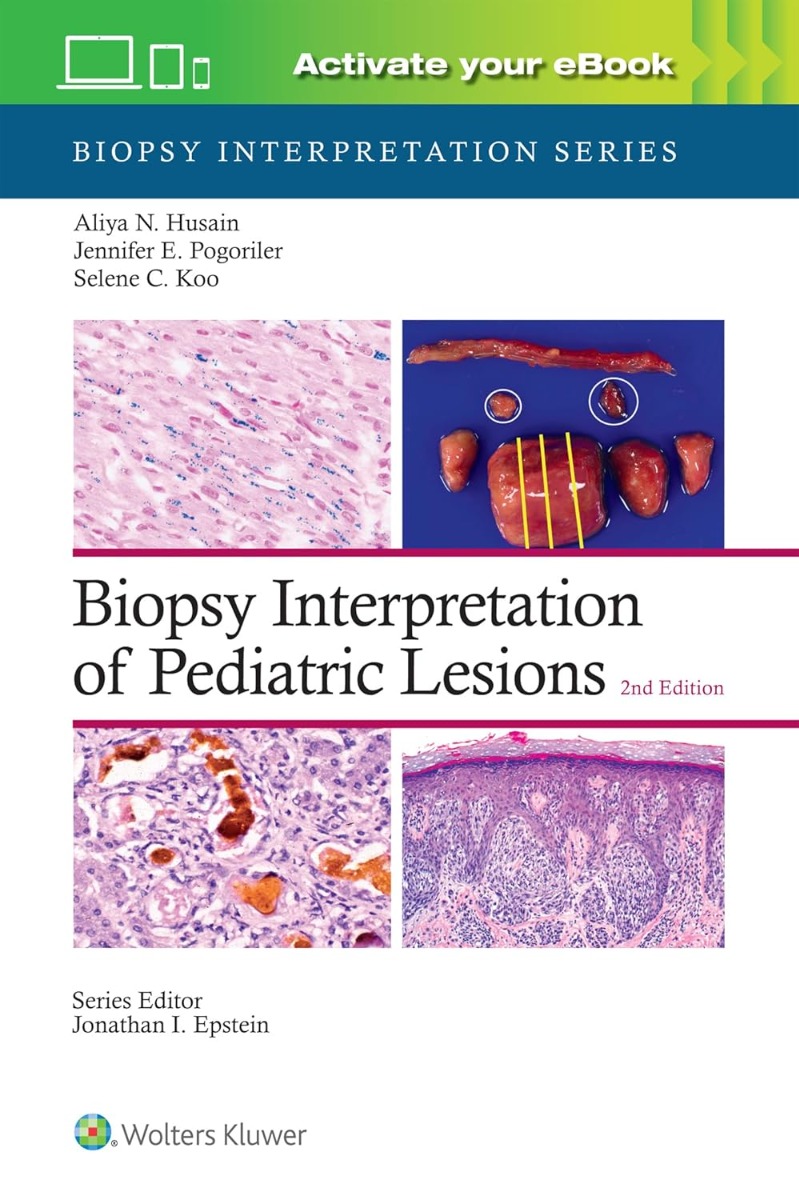 Biopsy Interpretation of Pediatric Lesions