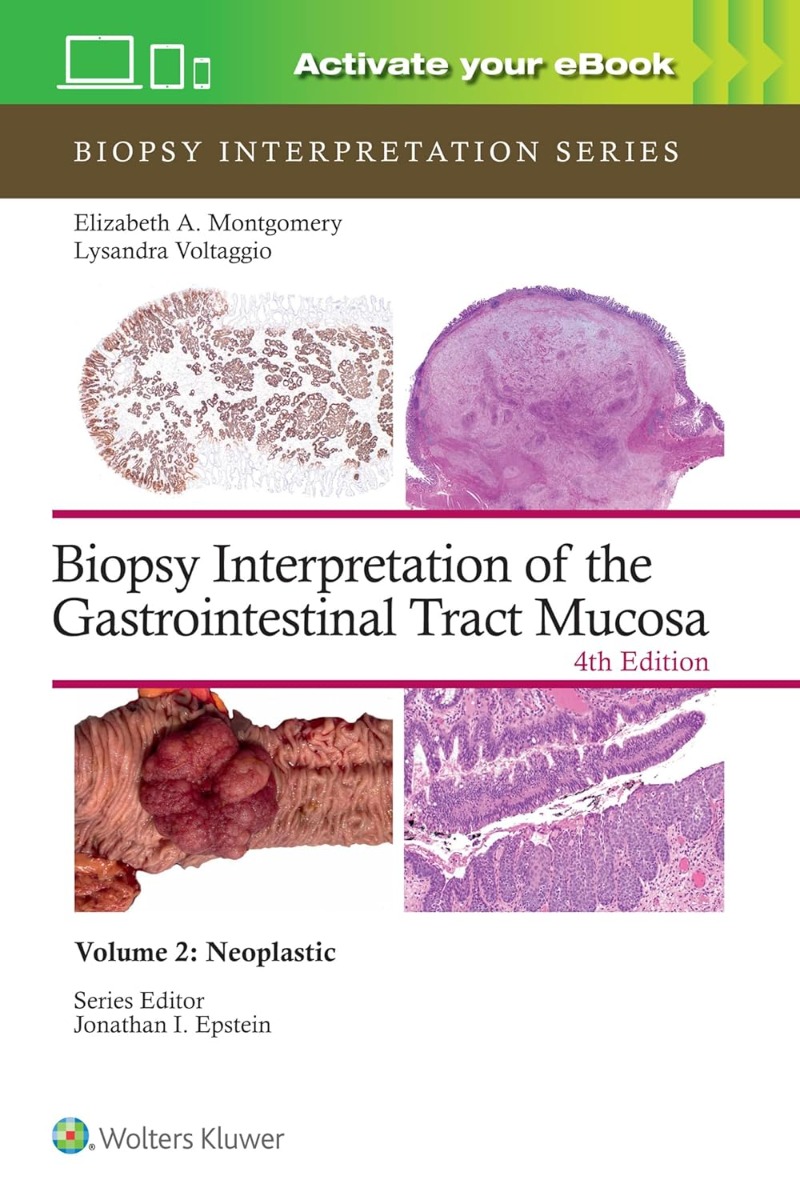 Biopsy Interpretation of the Gastrointestinal Tract Mucosa Volume 2