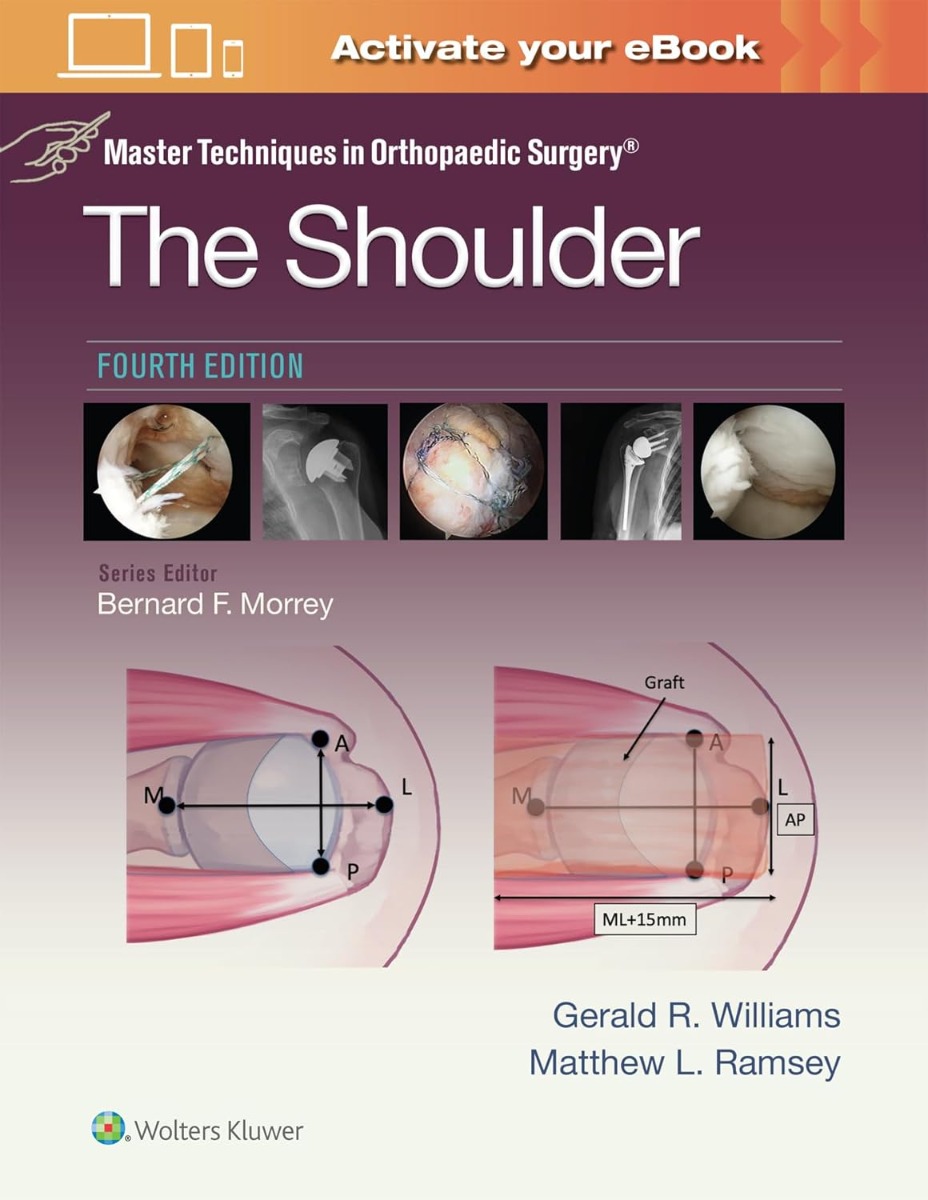 Master Techniques in Orthopaedic Surgery: The Shoulder