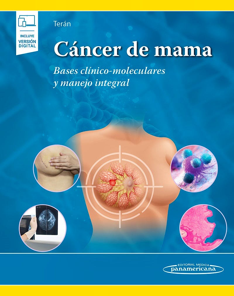 Cáncer de mama Bases clínico-moleculares y manejo integral