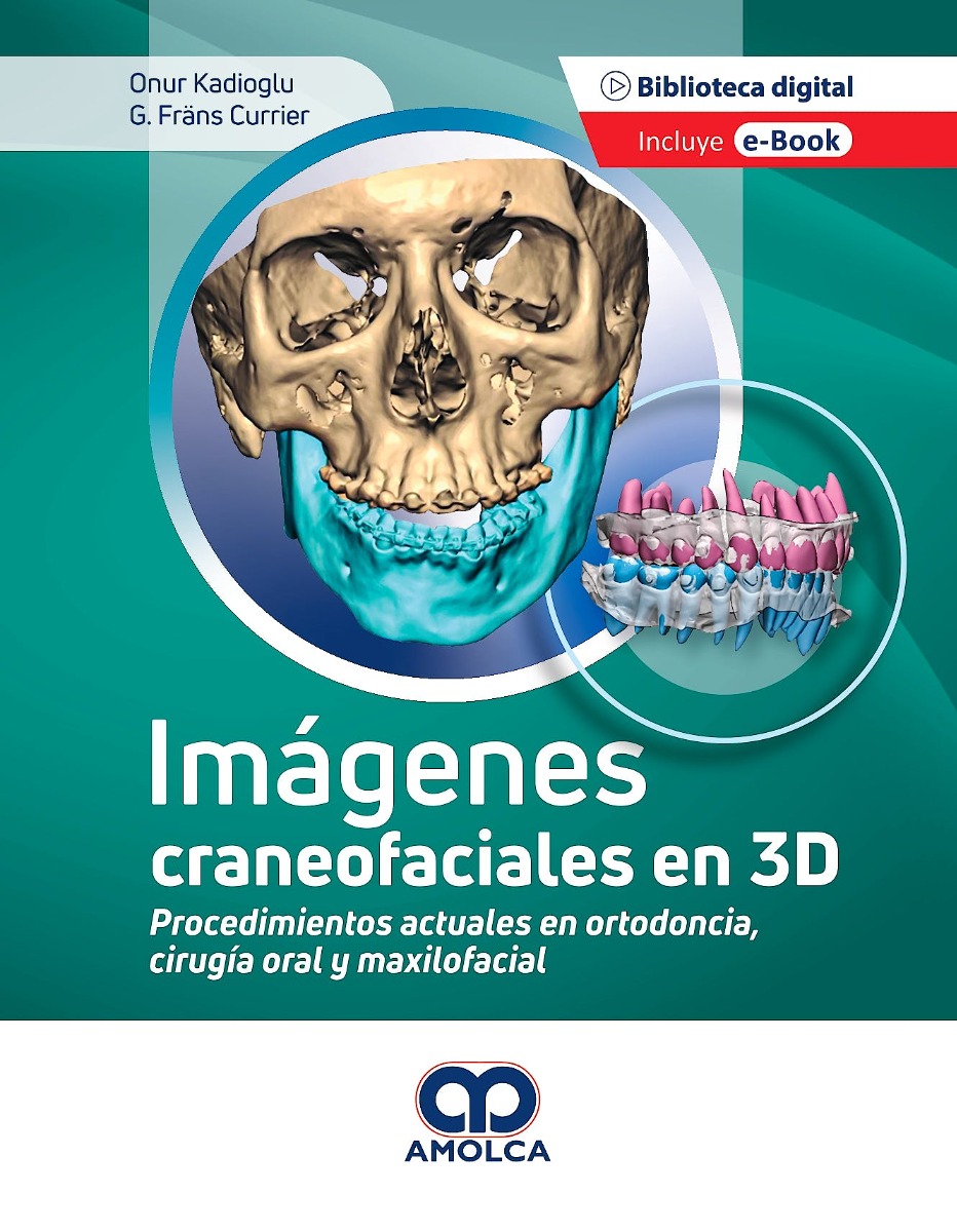 Imágenes Craneofaciales en 3D