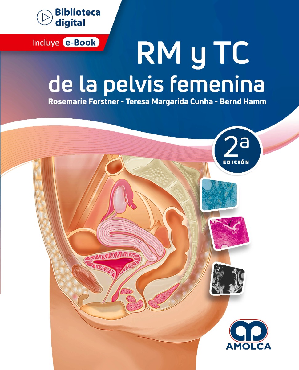 RM y TC de la Pelvis Femenina