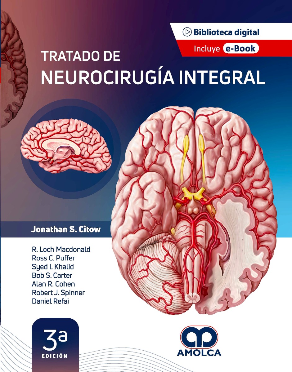 Tratado de Neurocirugía Integral