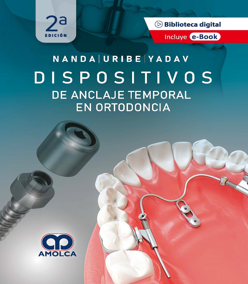 Dispositivos de Anclaje Temporal en Ortodoncia