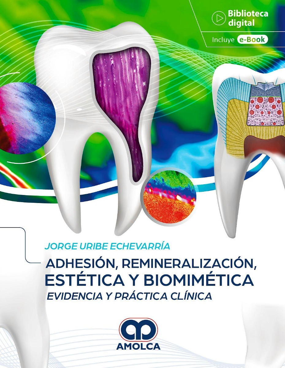 Adhesión, Remineralización, Estética y Biomimética. Evidencia y Práctica Clínica