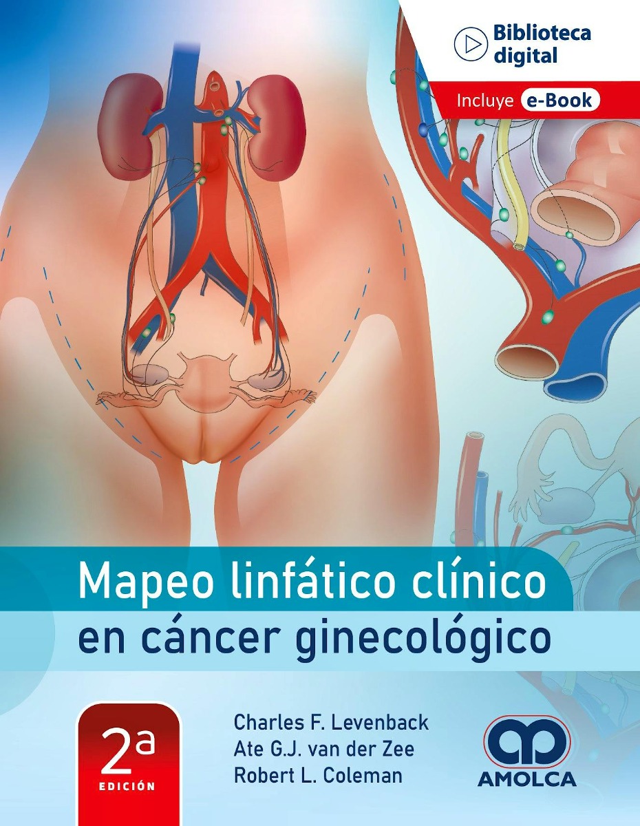 Mapeo Linfático Clínico en Cáncer Ginecológico