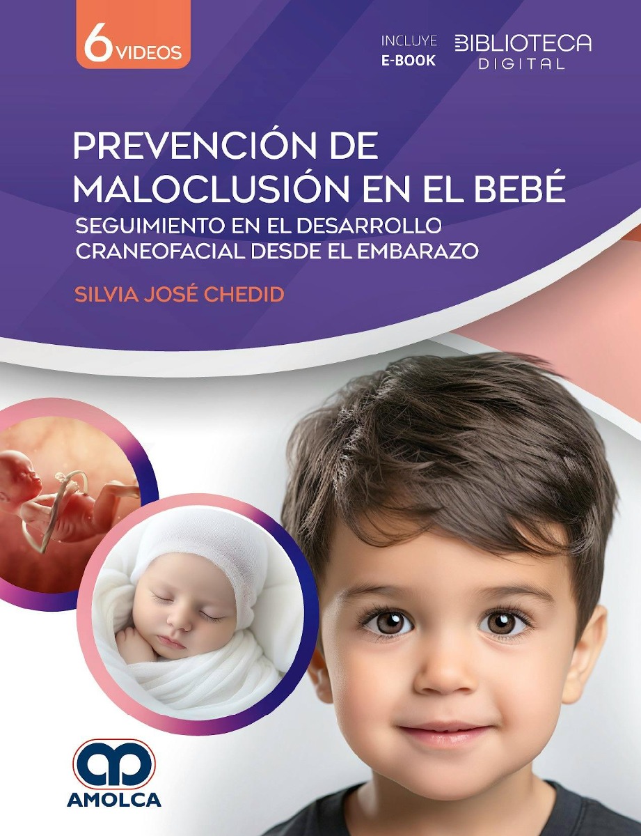 Prevención de Maloclusión en el Bebé. Seguimiento en el Desarrollo Craneofacial desde el Embarazo