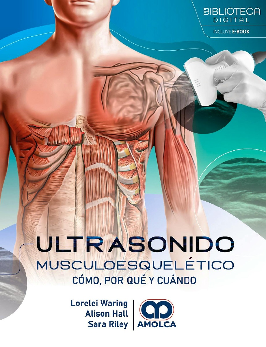 Ultrasonido Musculoesquelético. Cómo, Por Qué y Cuándo