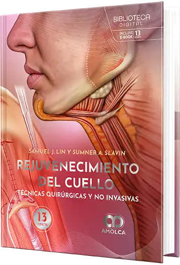 Rejuvenecimiento del Cuello. Técnicas Quirúrgicas y no Invasivas