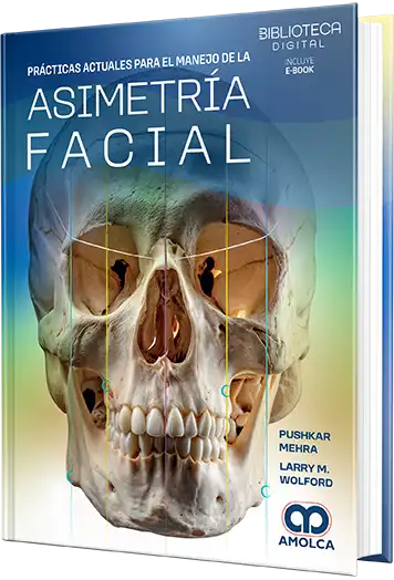 Manejo de la Asimetría Facial. Principios y Prácticas Actuales