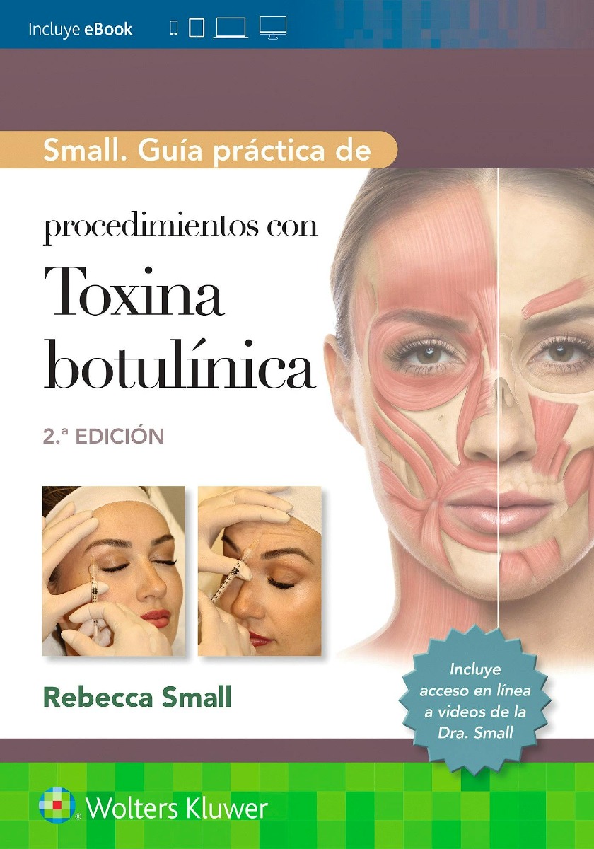 Small. Guía práctica de procedimientos con toxina botulínica