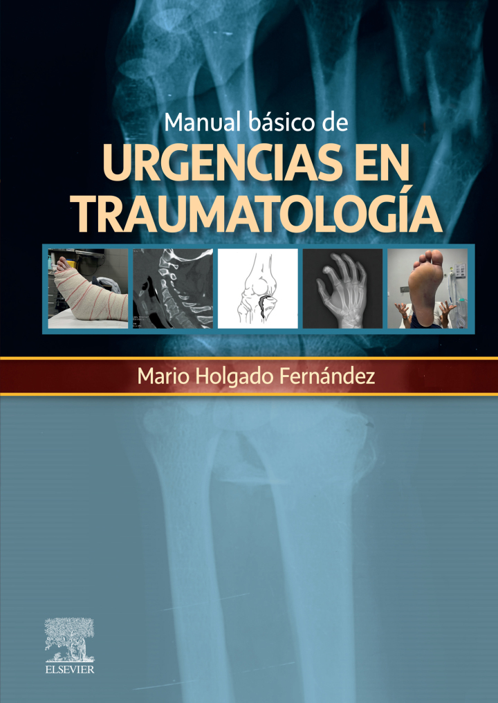 Manual Básico De Urgencias En Traumatología.