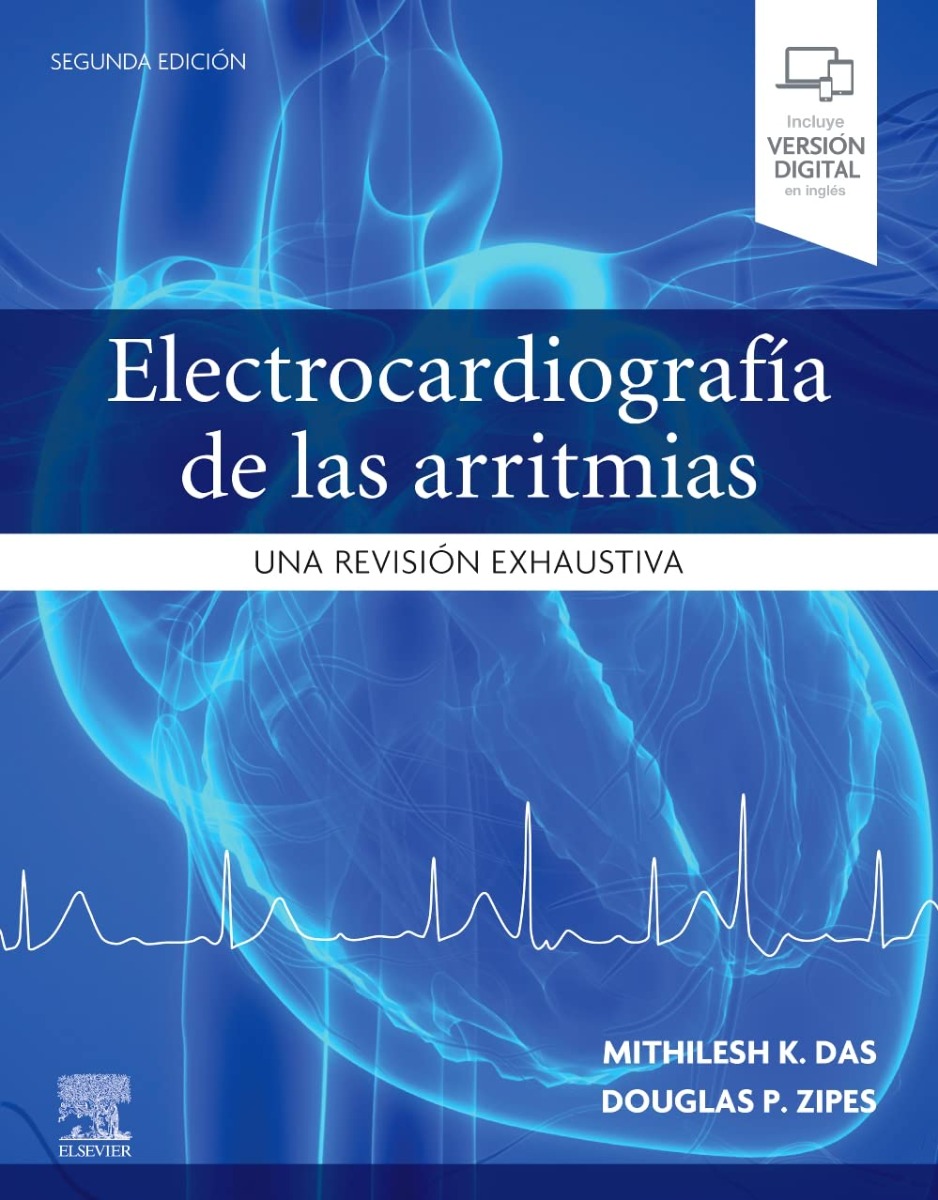 Electrocardiografía De Las Arritmias. Una Revisión Exhaustiva.