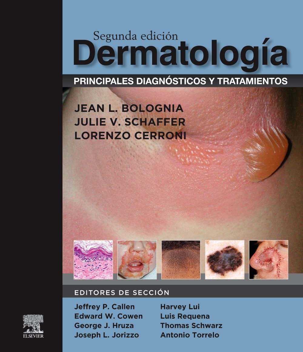 Dermatología. Principales Diagnósticos y Tratamientos