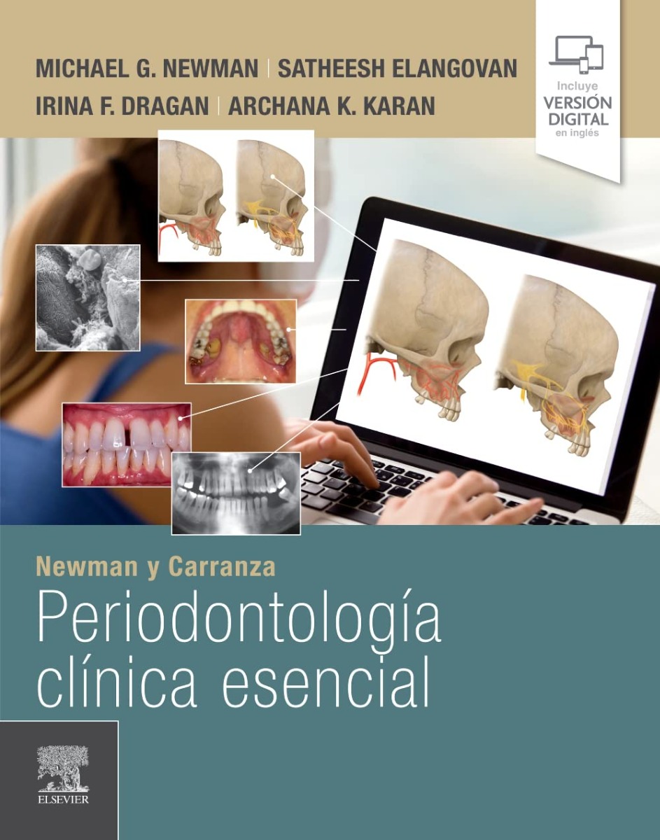 NEWMAN y CARRANZA Periodontología Clínica Esencial
