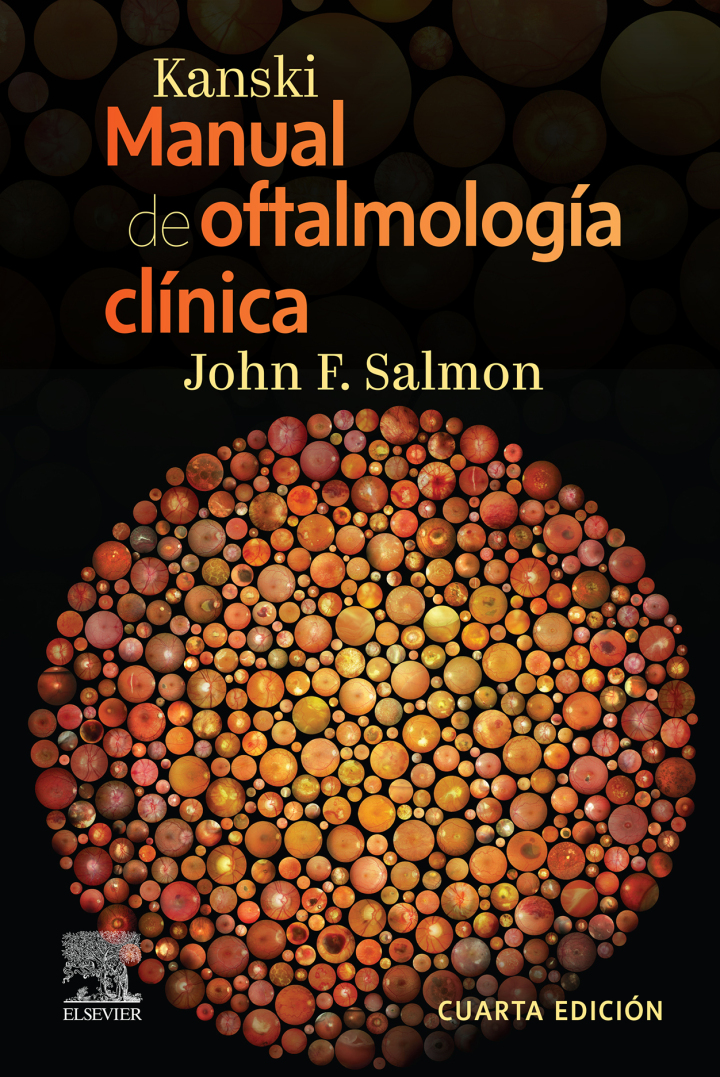 KANSKI Manual de Oftalmología Clínica