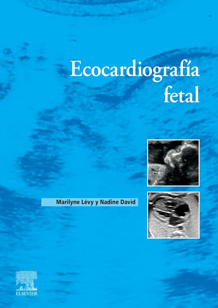 Ecocardiografía fetal 1ª