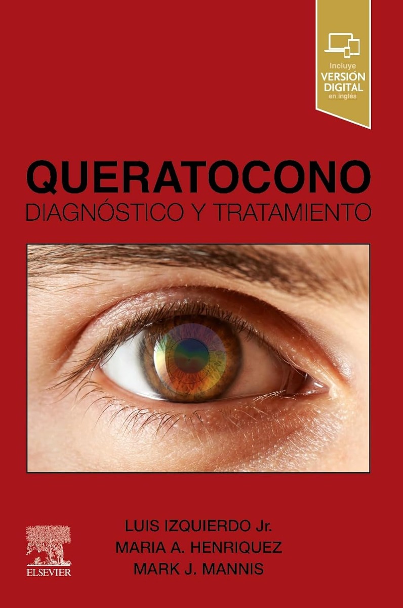 Queratocono. Diagnóstico y Tratamiento