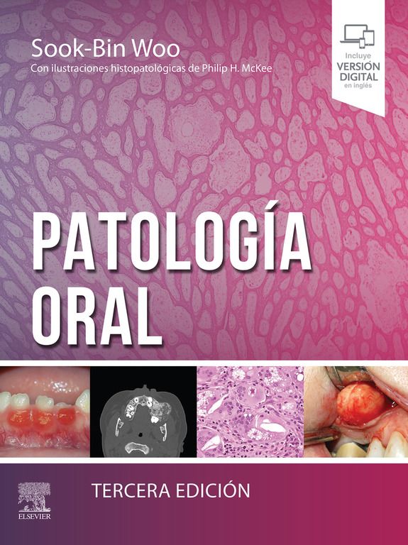 Patología Oral 3ª