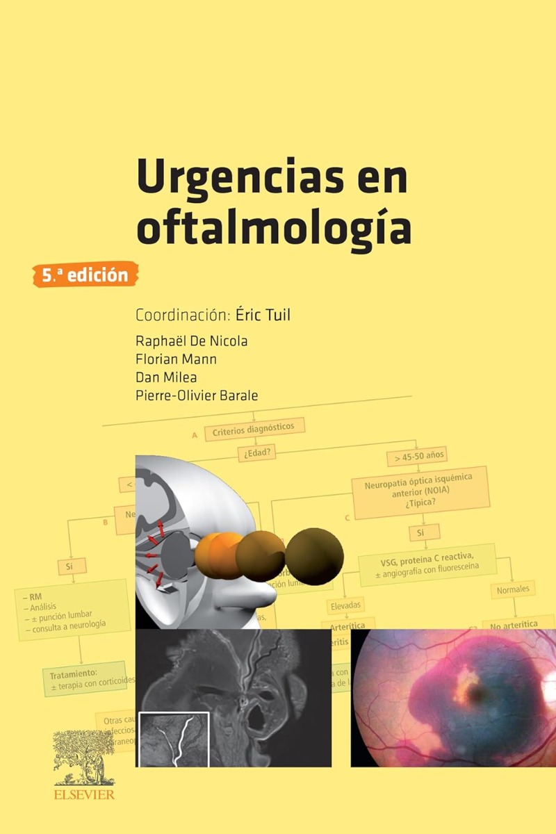 Urgencias en oftalmología 5ª