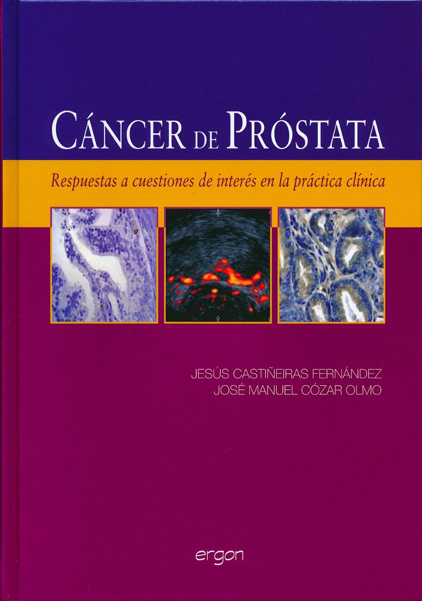Cáncer de Próstata.