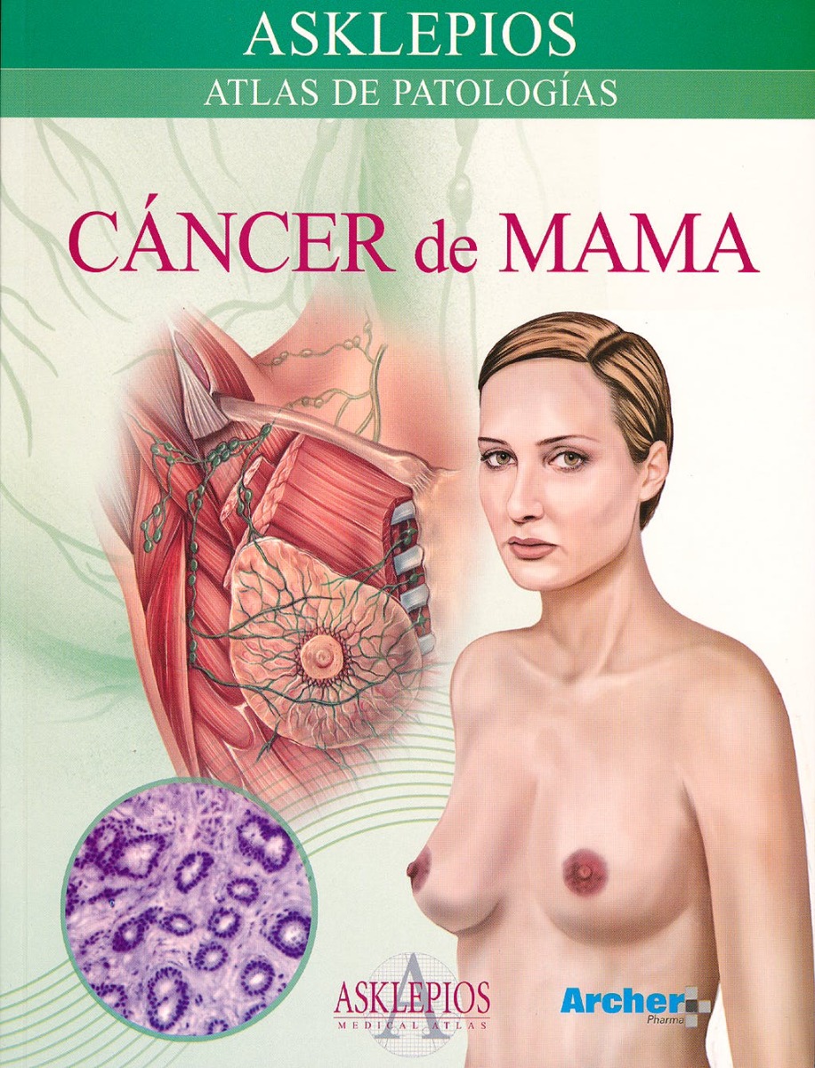 Cancer De Mama