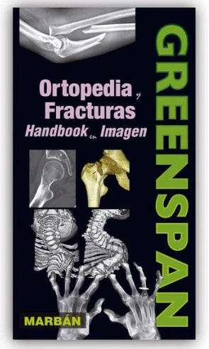 Ortopedia Y Fracturas Img, Handbook