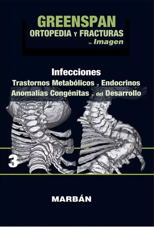 Ortopedia Y Fracturas Img, Tomo 3, Infecciones