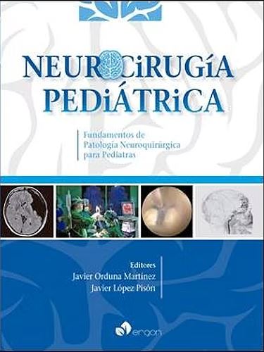 Neurocirugía Pediátrica. Fundamentos De Patología Neuroquirúrgica Para Pediatras
