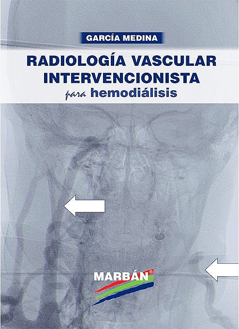Radiología Vascular Intervencionista Para Hemodiálisis