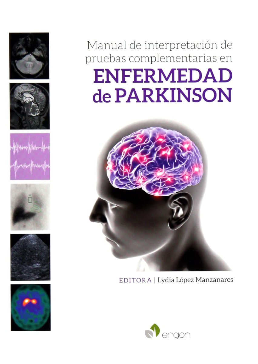Manual de interpretación de pruebas complementarias en enfermedad de Parkinson