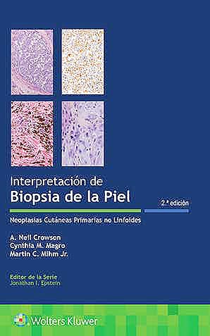 Interpretación De Biopsias De La Piel .