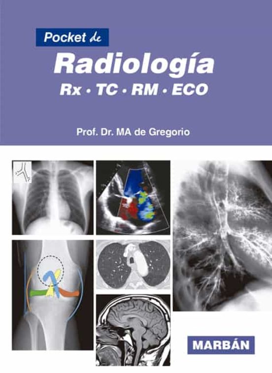 Pocket De Radiología. Rx, Tc, Rm, Eco