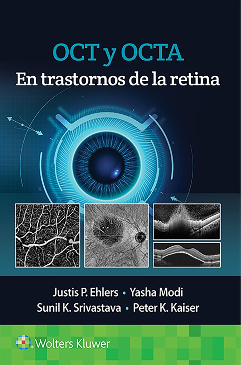 OCT y OCTA en Trastornos de la Retina