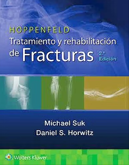Hoppenfeld Tratamiento Y Rehabilitación De Fracturas.